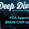 FDA Approves Brain Chip Implant